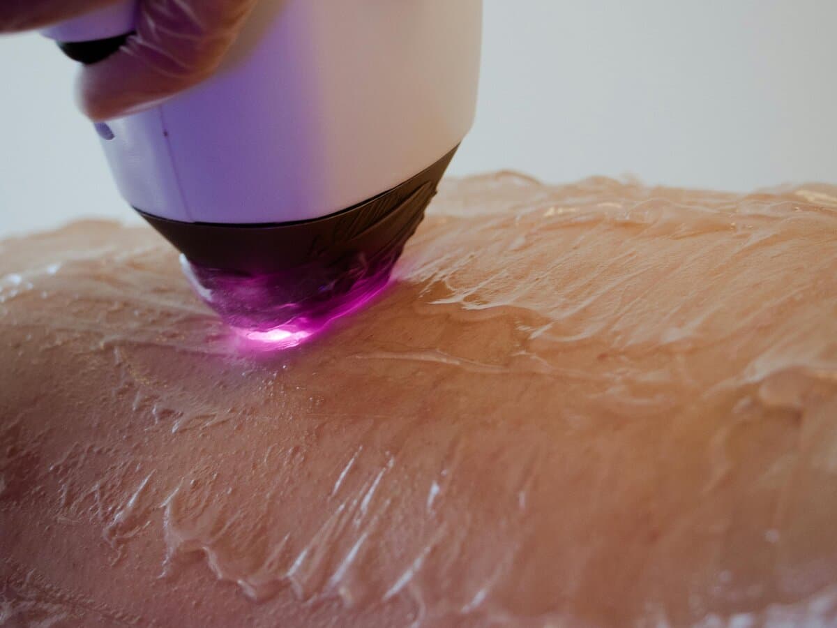 Epilare - programări online pe Glamingo